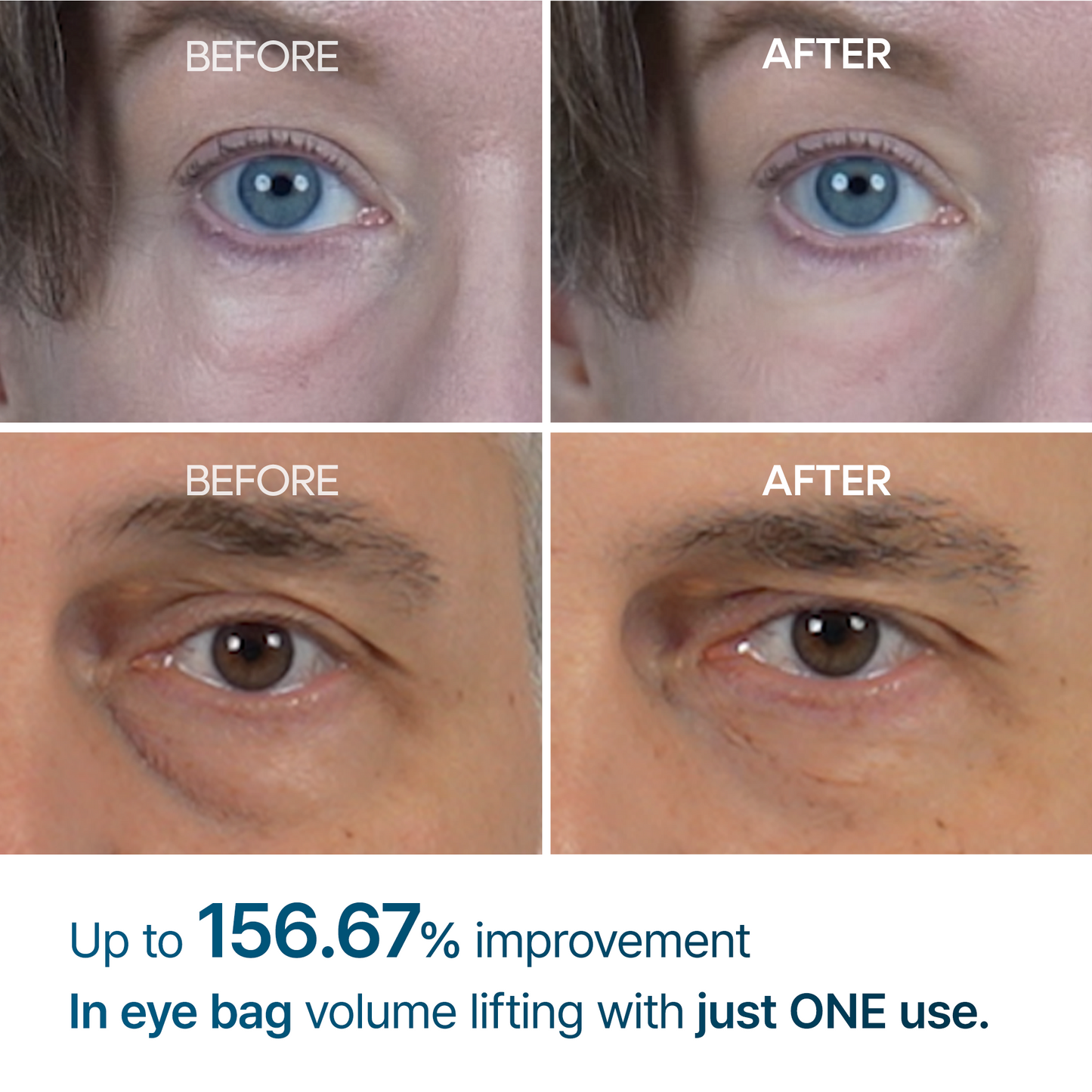 Eyephalt eyebag cream